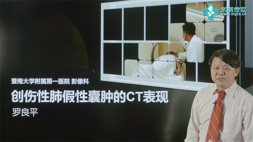 肺假性囊肿