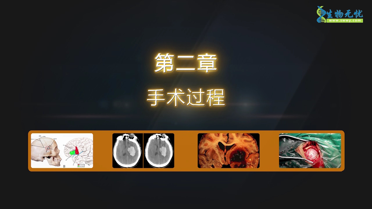 侧裂入路血肿清除术课堂