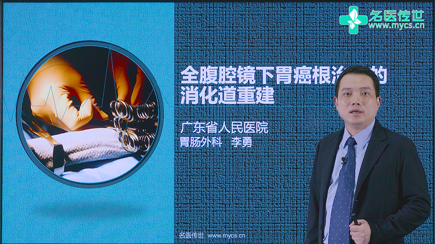 腹腔镜下胃癌根治术