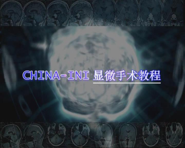 面——舌下神经吻合