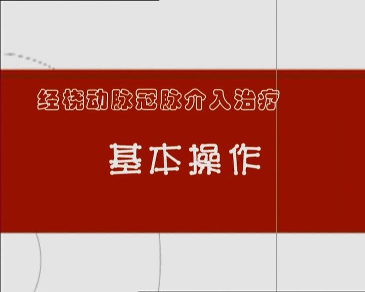 经桡动脉冠脉介入治疗